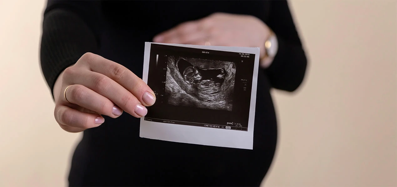 Těhotná žena drží v ruce ultrazvukový snímek plodu.